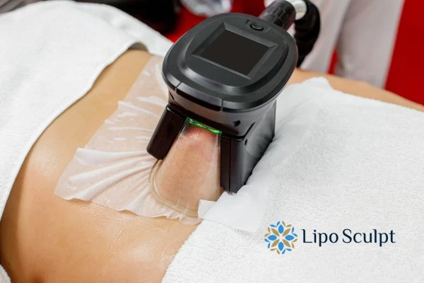 Does Fat Freezing at Home Work? DIY Devices vs Professional Cryolipolysis 1 How is professional cryolipolysis different Crawley Down?