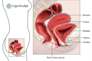Treatment For A Leaky Bladder 2 How EM Chair treatment Crawley Down can help Leaky bladder issues. Read more now!