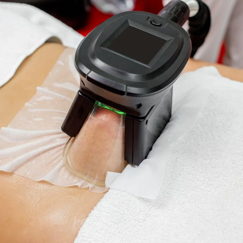 Fat Freezing treatment Crawley Down